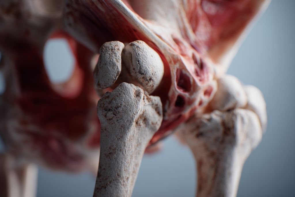 Symptôme tendinite moyen fessier comprendre les douleurs à la hanche et leurs traitements efficaces